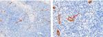 ADAM15 Antibody in Immunohistochemistry (Paraffin) (IHC (P))