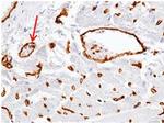 ADAM15 Antibody in Immunohistochemistry (Paraffin) (IHC (P))