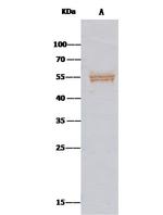 Angiotensinogen Antibody in Immunoprecipitation (IP)