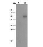 ALDH7A1 Antibody in Western Blot (WB)