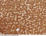 ALDH7A1 Antibody in Immunohistochemistry (Paraffin) (IHC (P))