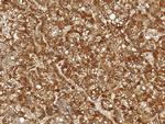 ALDH7A1 Antibody in Immunohistochemistry (Paraffin) (IHC (P))