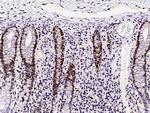 ASF1B Antibody in Immunohistochemistry (Paraffin) (IHC (P))