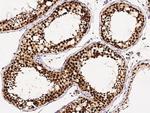 ASF1B Antibody in Immunohistochemistry (Paraffin) (IHC (P))