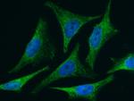 BID Antibody in Immunocytochemistry (ICC/IF)