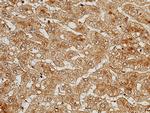 Complement C5 Antibody in Immunohistochemistry (Paraffin) (IHC (P))