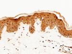 Caspase 14 Antibody in Immunohistochemistry (Paraffin) (IHC (P))