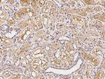 CD200 Antibody in Immunohistochemistry (Paraffin) (IHC (P))