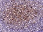 CD200 Antibody in Immunohistochemistry (Paraffin) (IHC (P))