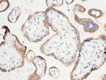 PD-L1 Antibody in Immunohistochemistry (Paraffin) (IHC (P))