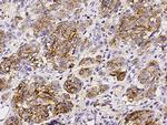 CD63 Antibody in Immunohistochemistry (Paraffin) (IHC (P))