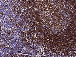 CD74 Antibody in Immunohistochemistry (Paraffin) (IHC (P))