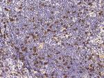 CD8 beta Antibody in Immunohistochemistry (Paraffin) (IHC (P))