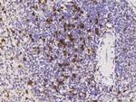 CD8 beta Antibody in Immunohistochemistry (Paraffin) (IHC (P))