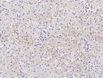 CES3 Antibody in Immunohistochemistry (Paraffin) (IHC (P))