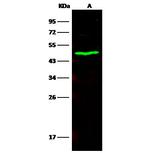 CES3 Antibody in Western Blot (WB)