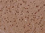 CHI3L2 Antibody in Immunohistochemistry (Paraffin) (IHC (P))