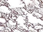 CHI3L2 Antibody in Immunohistochemistry (Paraffin) (IHC (P))