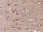 KIP2 Antibody in Immunohistochemistry (Paraffin) (IHC (P))