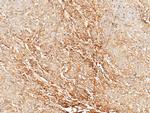 Tetranectin Antibody in Immunohistochemistry (Paraffin) (IHC (P))