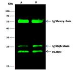 CRABP2 Antibody in Immunoprecipitation (IP)