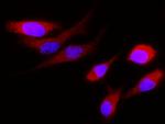 Cystatin S Antibody in Immunocytochemistry (ICC/IF)