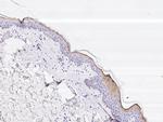 Cystatin A Antibody in Immunohistochemistry (Paraffin) (IHC (P))