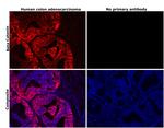 beta Catenin Antibody in Immunohistochemistry (Paraffin) (IHC (P))