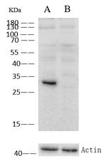 Cathepsin D Antibody in Western Blot (WB)