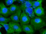 DARS Antibody in Immunocytochemistry (ICC/IF)