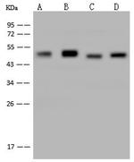 NSE Antibody in Western Blot (WB)