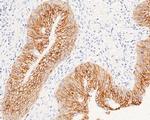 EpCAM Antibody in Immunohistochemistry (Paraffin) (IHC (P))