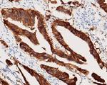 EpCAM Antibody in Immunohistochemistry (Paraffin) (IHC (P))