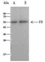 Factor IX Antibody in Immunoprecipitation (IP)