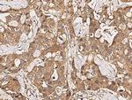 FGFR3 Antibody in Immunohistochemistry (Paraffin) (IHC (P))