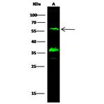 GFR alpha-2 Antibody in Western Blot (WB)