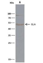 alpha Galactosidase Antibody in Immunoprecipitation (IP)