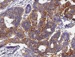 A33 Antibody in Immunohistochemistry (Paraffin) (IHC (P))