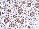 A33 Antibody in Immunohistochemistry (Paraffin) (IHC (P))