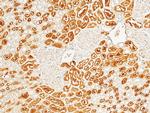 HAGH Antibody in Immunohistochemistry (Paraffin) (IHC (P))