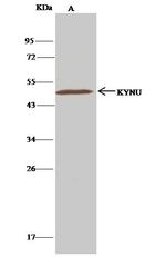 KYNU Antibody in Immunoprecipitation (IP)