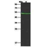 KYNU Antibody in Western Blot (WB)