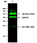 RAP Antibody in Immunoprecipitation (IP)