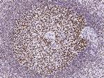 MSH6 Antibody in Immunohistochemistry (Paraffin) (IHC (P))