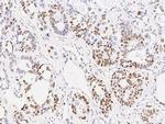 MSH6 Antibody in Immunohistochemistry (Paraffin) (IHC (P))