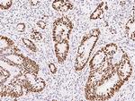 MSH6 Antibody in Immunohistochemistry (Paraffin) (IHC (P))