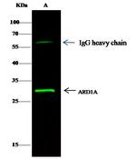 ARD1A Antibody in Immunoprecipitation (IP)