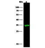 ARD1A Antibody in Western Blot (WB)