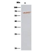 PDI Antibody in Immunoprecipitation (IP)