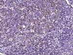 PD-1 Antibody in Immunohistochemistry (Paraffin) (IHC (P))